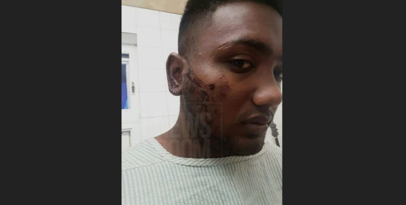 Man shot in face after fighting off bandits