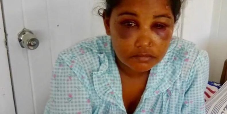 Pregnant woman hospitalised after severe beating by husband