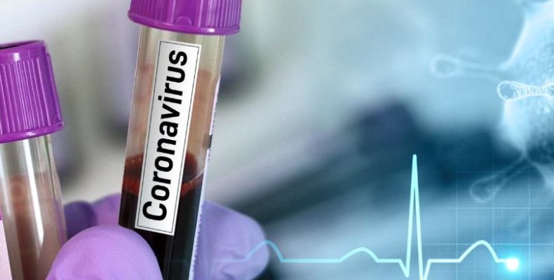 Guyana records 3 new cases of coronavirus; New cases not linked to other cases