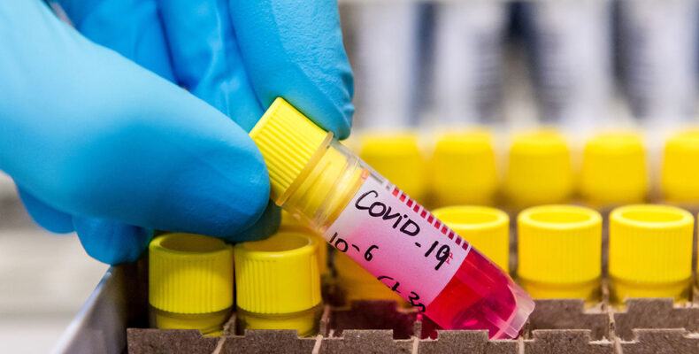 23 New COVID-19 cases and 1 new death in 24hrs