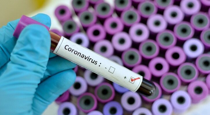 70 New COVID-19 Cases recorded today; 8 in ICU