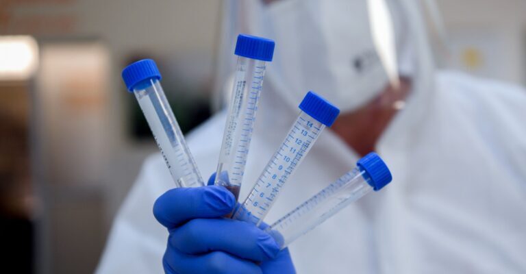 35 New COVID-19 cases recorded today; 333 Active cases allowed to home isolate