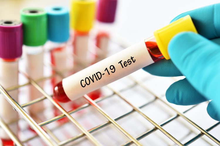24 new COVID-19 cases from 93 tests