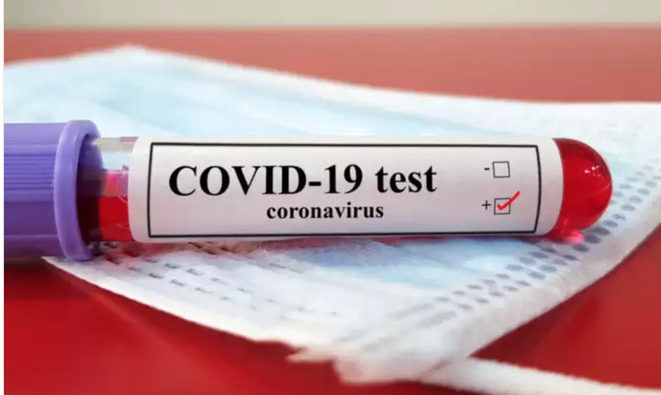 46-year-old woman is 107th COVID-19 death in Guyana