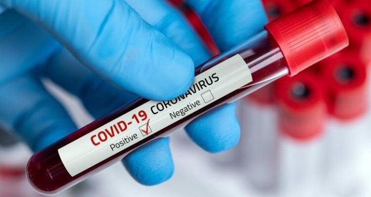 Guyana records 147th COVID-19 death
