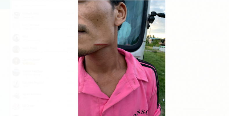 Berbice salesman shot in failed robbery attempt