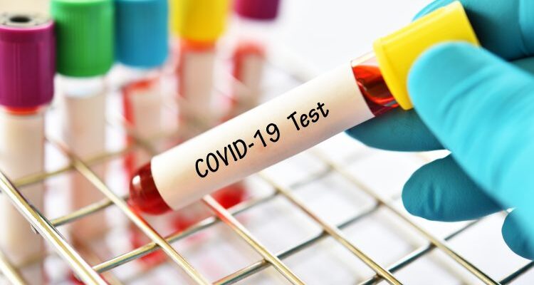29 new COVID-19 cases recorded from 330 tests