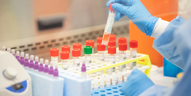 Guyana crosses 10,000 COVID cases milestone with 109 new cases in 24hrs