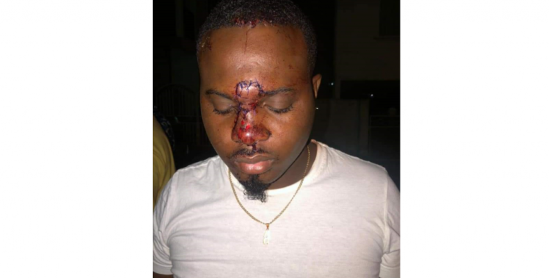 DJ attacked, stabbed to face during argument