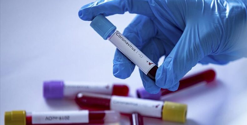 COVID-19 Hospitalisations on the rise; Region 4 hotspots identified