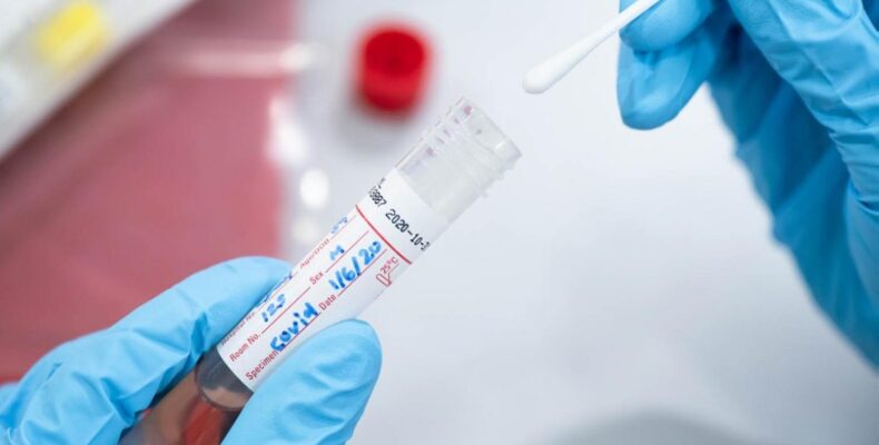 1,723 new COVID cases and 40 deaths in Guyana since April 1