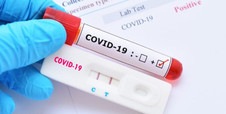 10 deaths and 520 new COVID cases recorded in 4 days