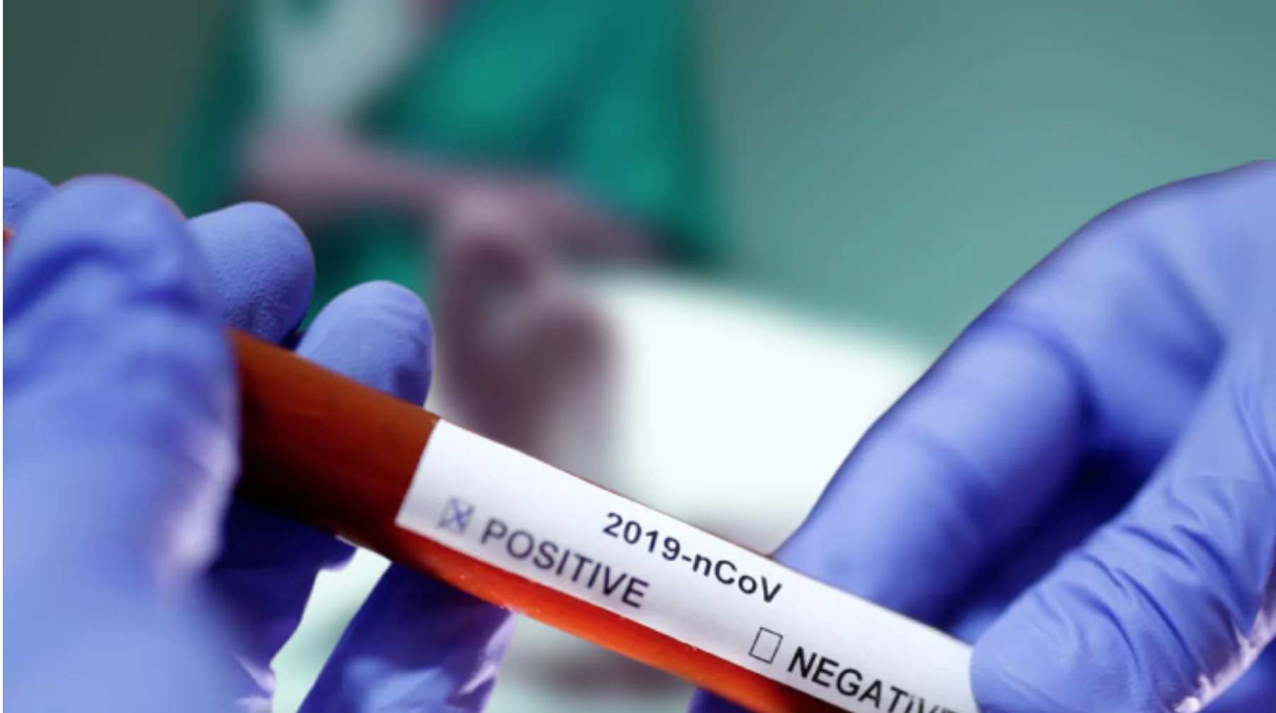 Nine Coronavirus deaths recorded; New infections climb to 920 in 7 days