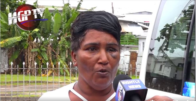Woman allegedly brutalised by cops but remanded to prison for assault