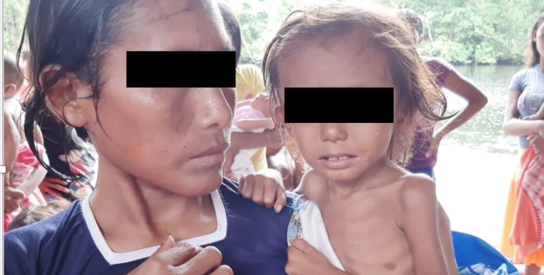 Malnourished children found in Region One indigenous community; Government sends emergency help