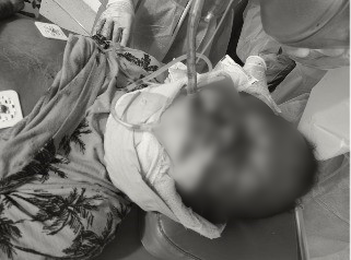 Police seeking help in identifying man who died in accident with lorry
