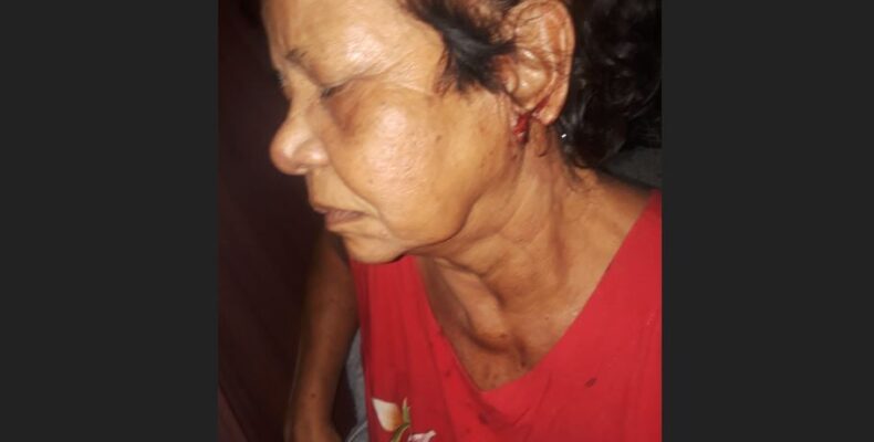 Pensioner nursing ripped earlobe; traumatised following armed robbery