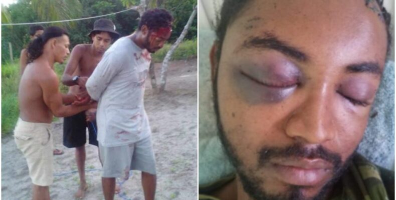 Linden technician accused of brutalizing wife in critical condition after ‘vigilante beating’