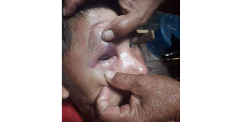 Cop under close arrest for allegedly assaulting man with a disability