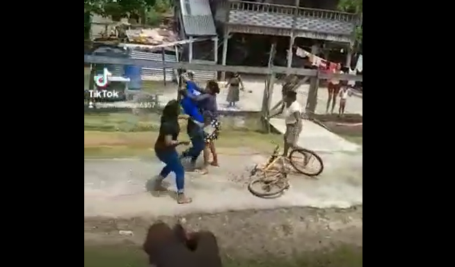 Two arrested for attacking, chopping Berbice woman