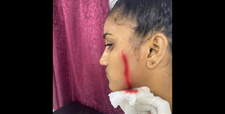 Pregnant woman slashes rival in the face
