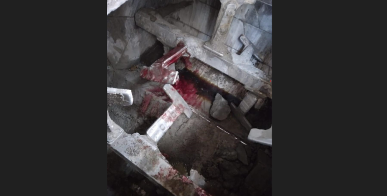 Teen battling for life after ‘cement mixer’ turned on with him inside