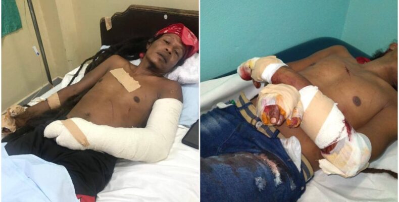 After facing a year of threats, single father severely chopped