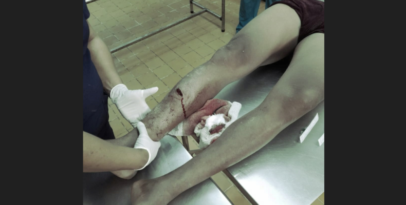 Man suffers fractured leg after refusing to buy alcohol for co-worker