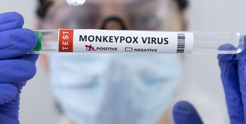 Surveillance team on ‘high alert’ for Monkeypox