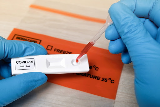 33 new COVID-19 cases recorded