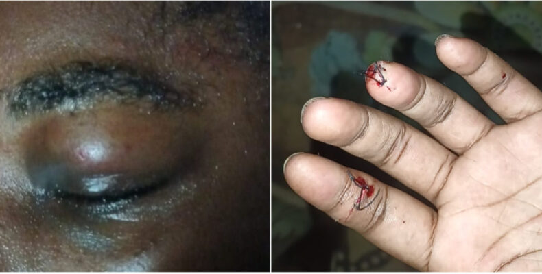 Woman, 23, bites attacker’s tongue during attempted rape
