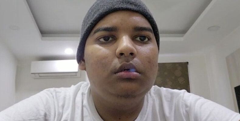 Sanjay has 80 per cent chance to beat cancer