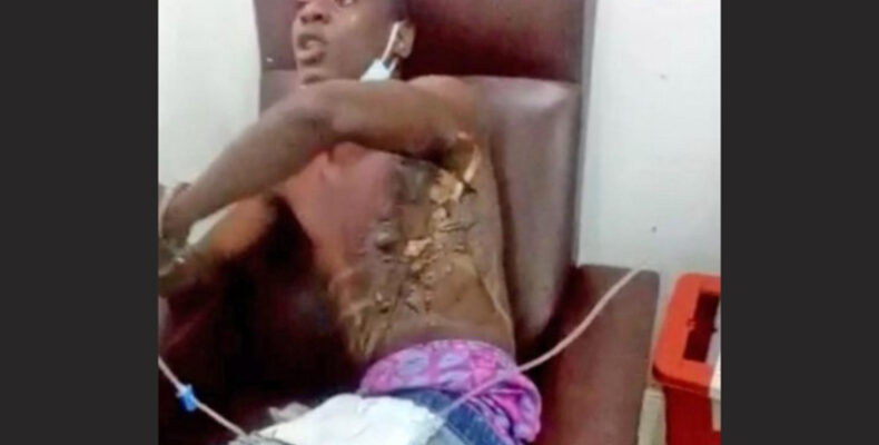 OPR investigating teen’s claim of police brutality
