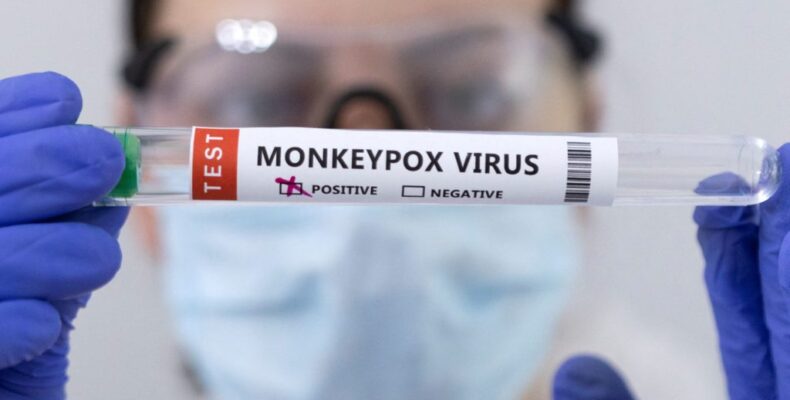 Monkeypox outbreak needs international response – Health Minister