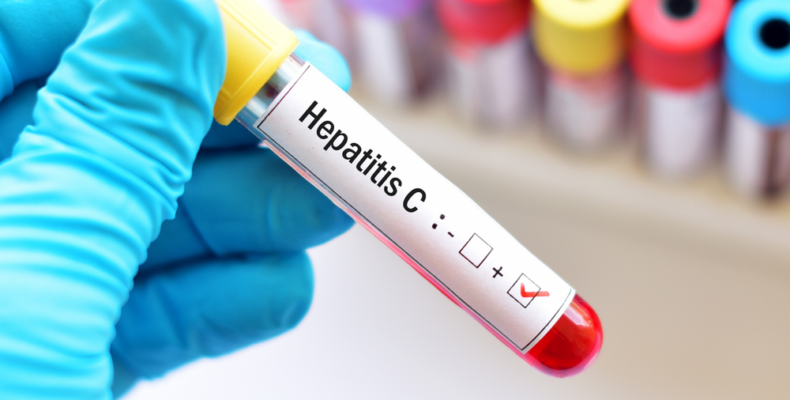 Free Hepatitis C treatment prog. to be launched this week