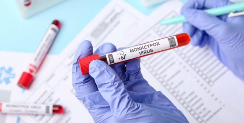 Training to start in Guyana to detect Monkeypox