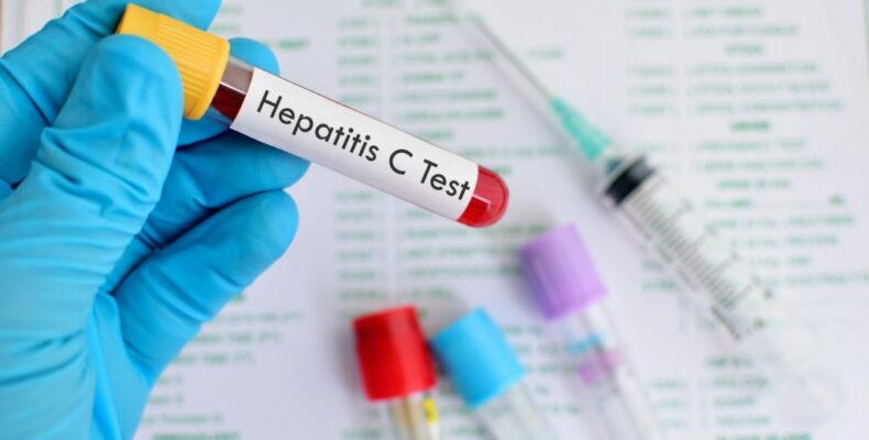 Expensive Hep C treatment now available in Guyana free of cost