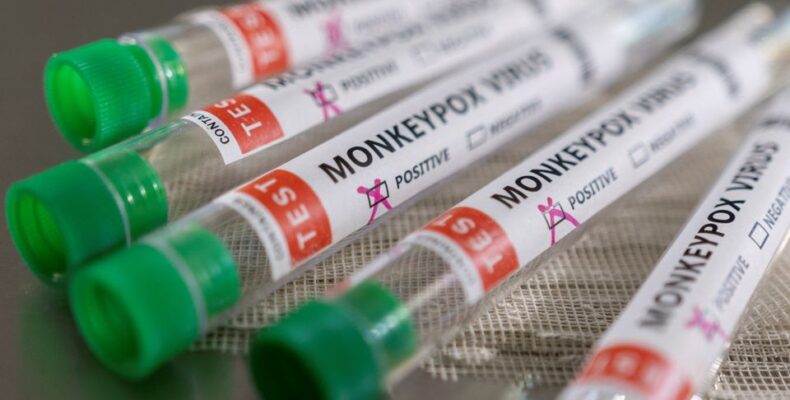 All suspected monkeypox cases in Guyana were negative – Dr. Anthony