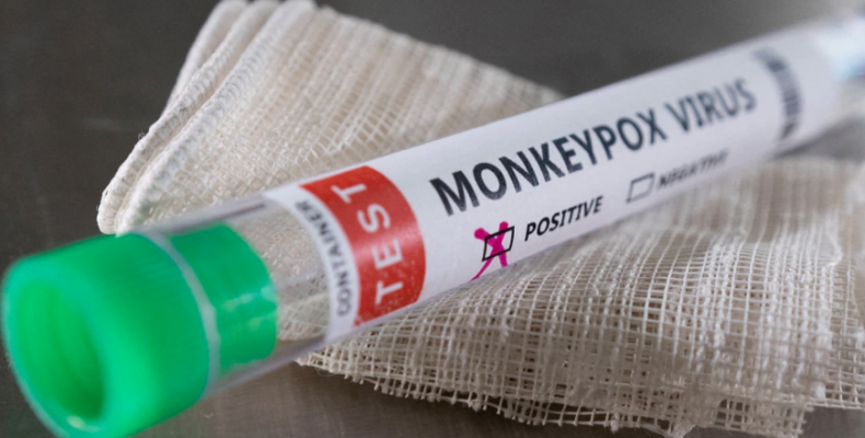 Region Four man diagnosed with Guyana’s first Monkey Pox case