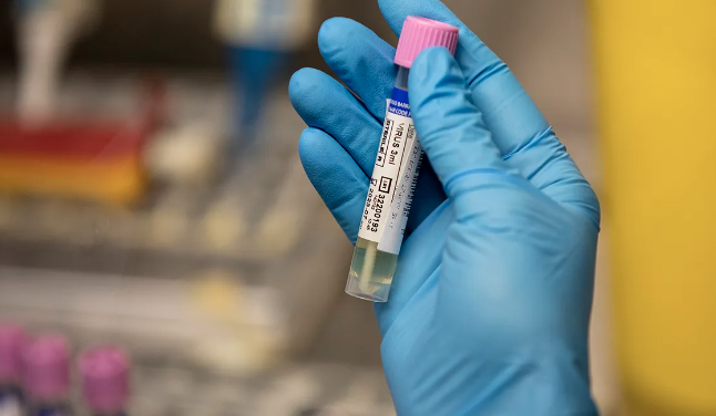 Close contacts of Monkeypox patient all test negative for the virus; Still being monitored