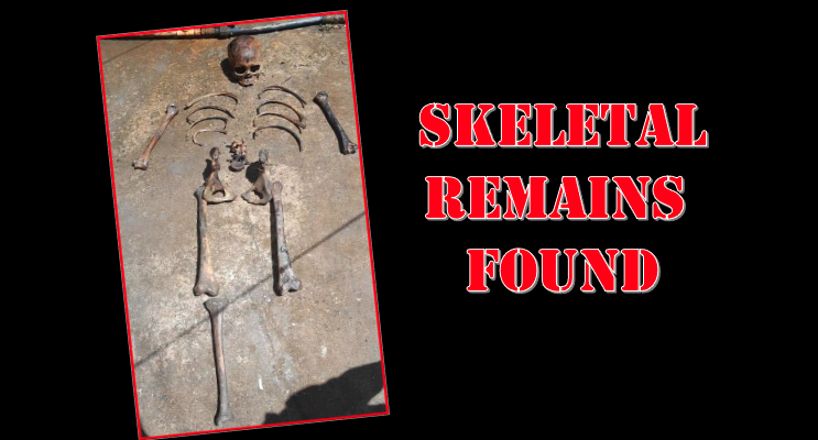 Police probing discovery of human skeletal remains on West Demerara beach